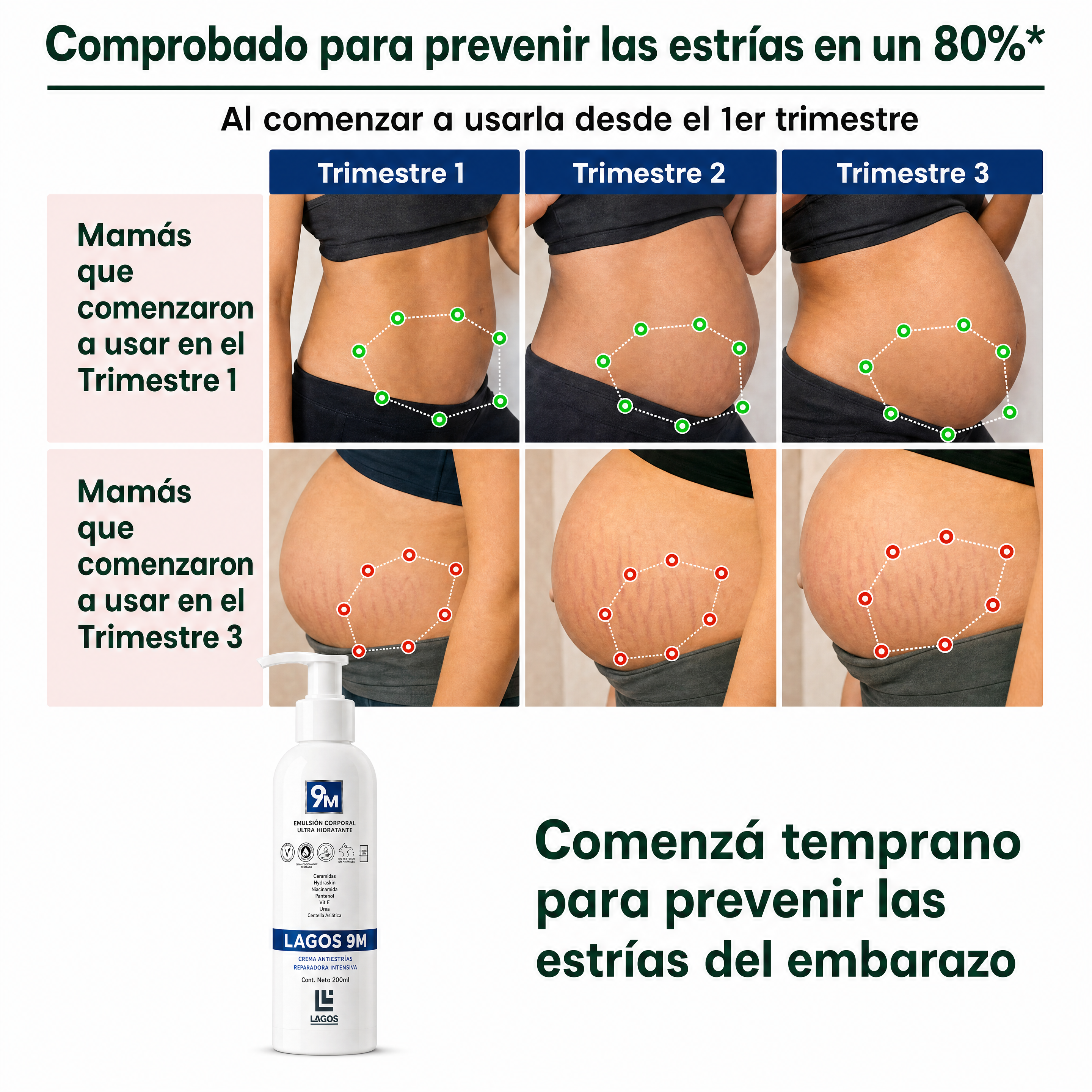 9M Crema Anti Estrias
