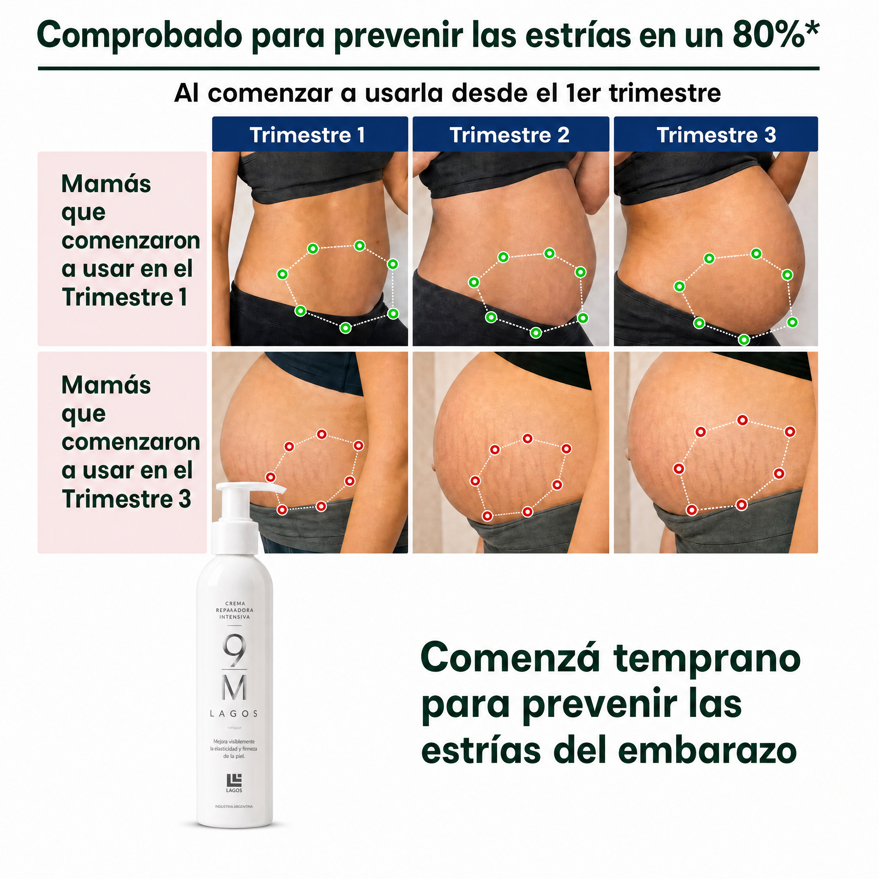9M Crema Anti Estrias