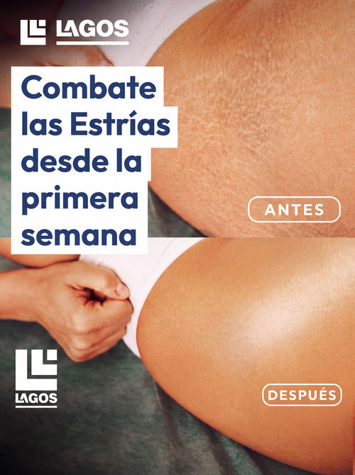 9M Crema Anti Estrias
